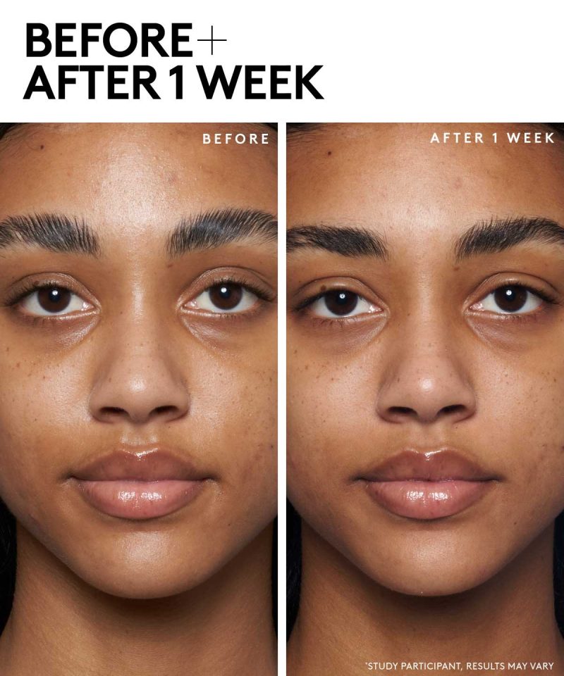 Alternative view of Cherry Dub Blah 2 Bright 5% AHA Face Mask