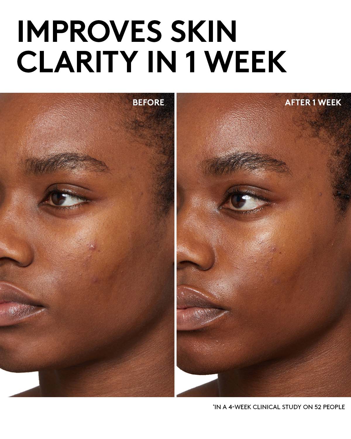 Fenty Skin Start'rs Full-Size Bundle: Oily Skin Edition - Image 3