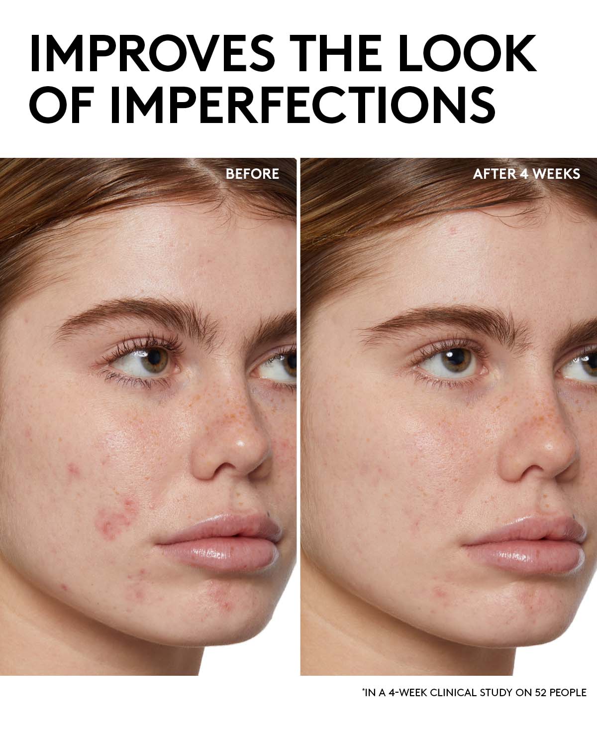 Fenty Skin Start'rs Full-Size Bundle: Oily Skin Edition - Image 4