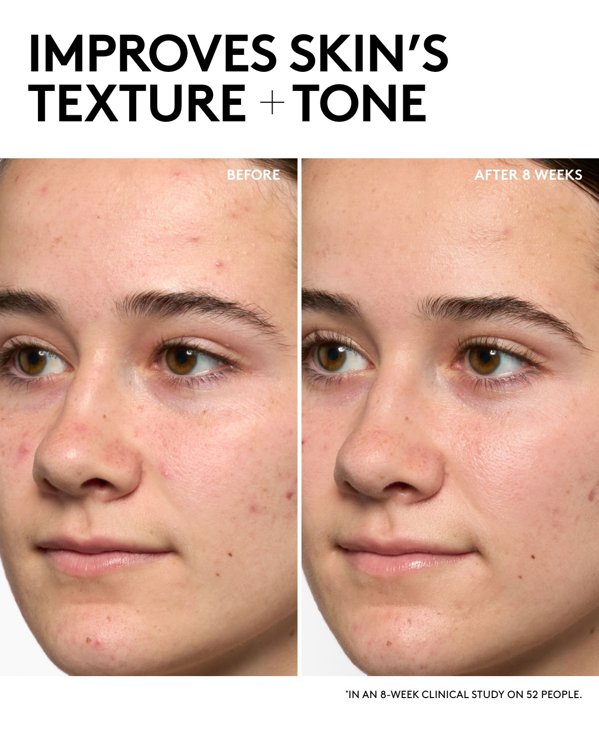 Hydra Vizor Refill Invisible Moisturizer Broad Spectrum Spf 30 Sunscreen with Niacinamide + Kalahari Melon - Image 4